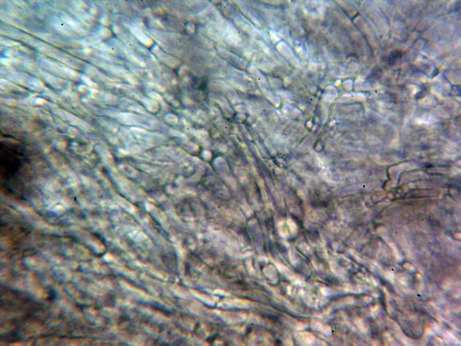 Microscopía de Lyophyllum decastes - 10 - Pileipellis 2
